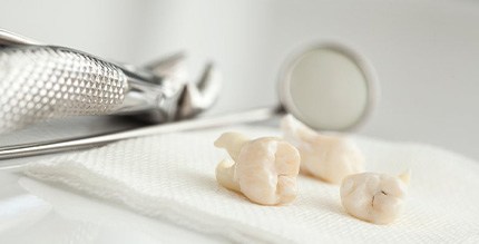 Three extracted teeth sitting on a napkin next to dental instruments